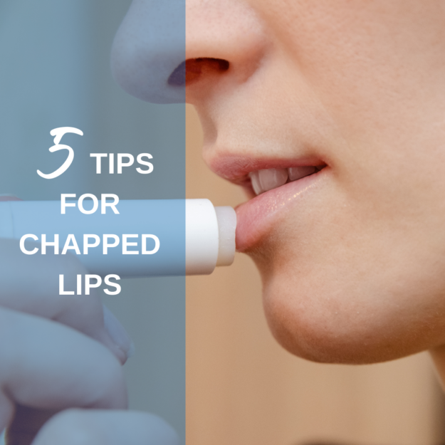 5 Tips for Chapped Lips 5 Tips for Chapped Lips