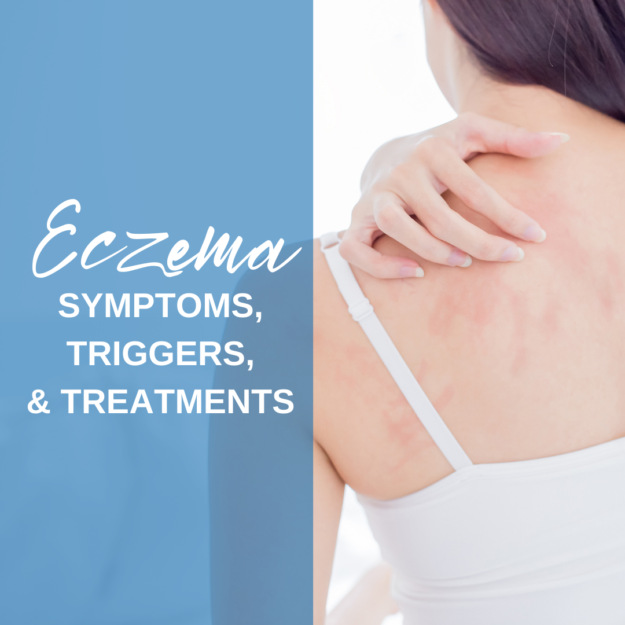 Eczema Symptoms, Triggers, and Treatments