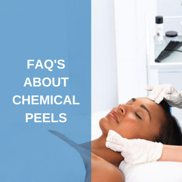 FAQ’s About Chemical Peels