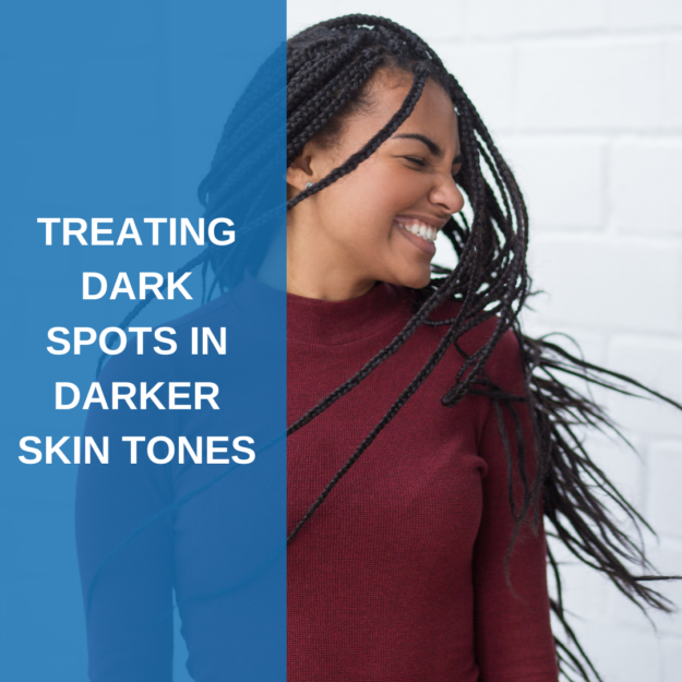 Treating Dark Spots