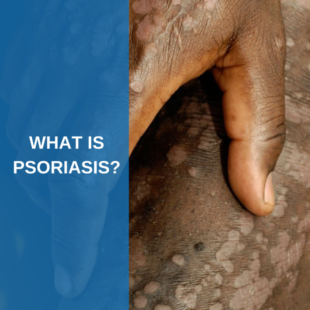 What is Psoriasis?