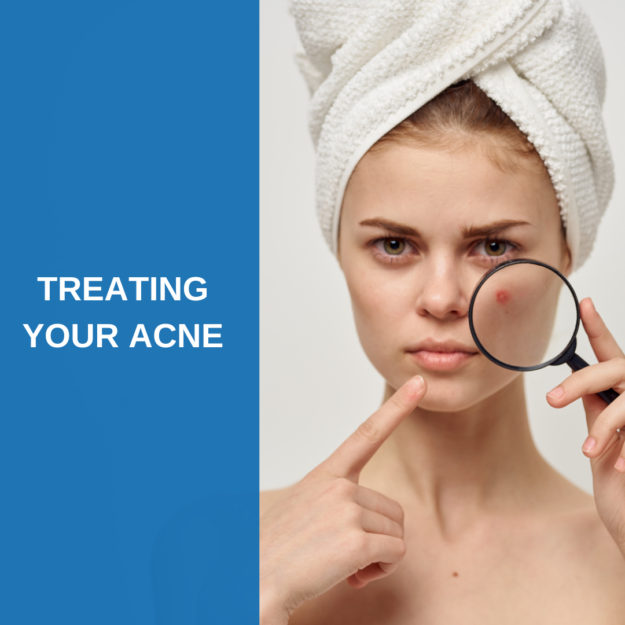Treating Your Acne