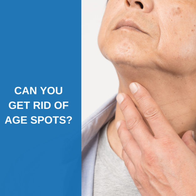 Can you get rid of age spots?