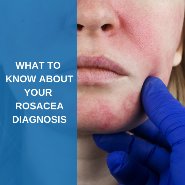 Rosacea