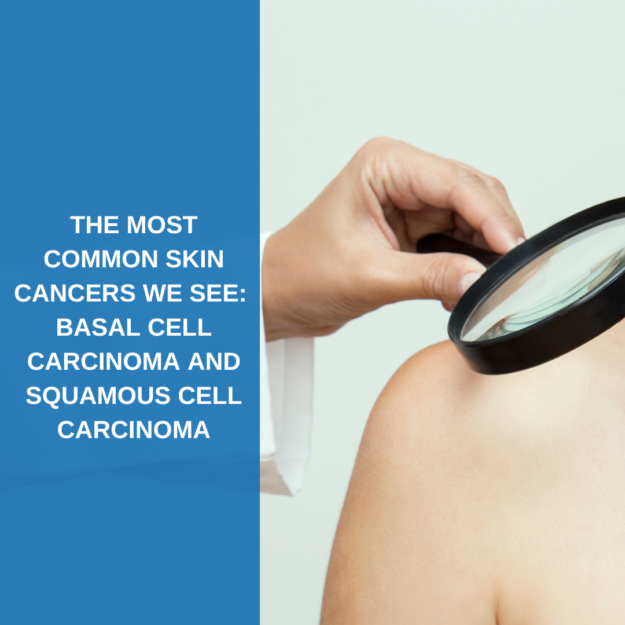Most Common Skin Cancers