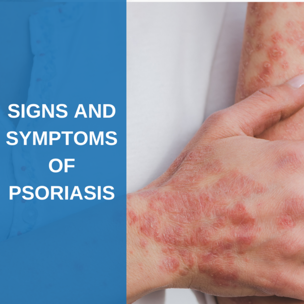 Signs and Symptoms of Psoriasis