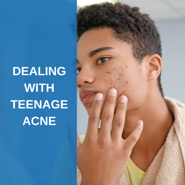 Dealing with Teen Acne