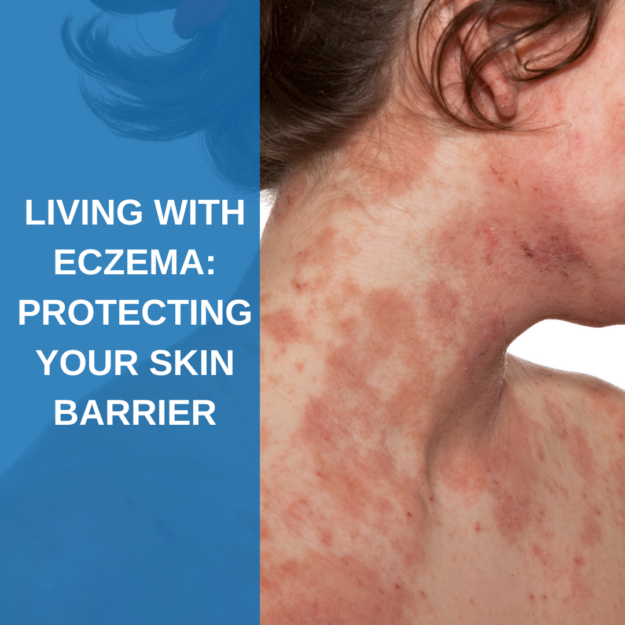 Living with Eczema: Protecting your skin barrier