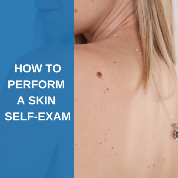 How to perform a skin self-exam
