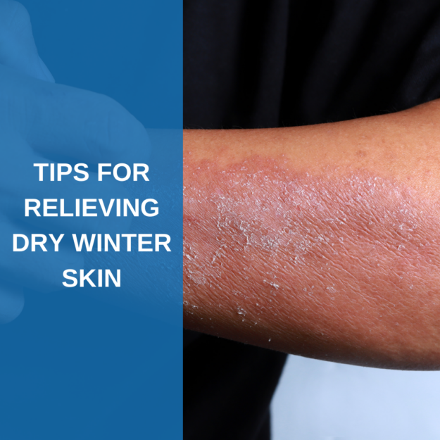 Tips for Dry Skin