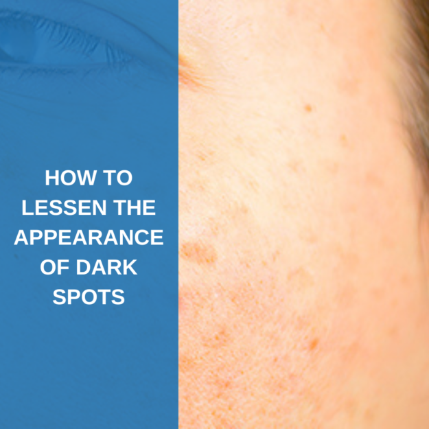 lessen the appearance of dark spots