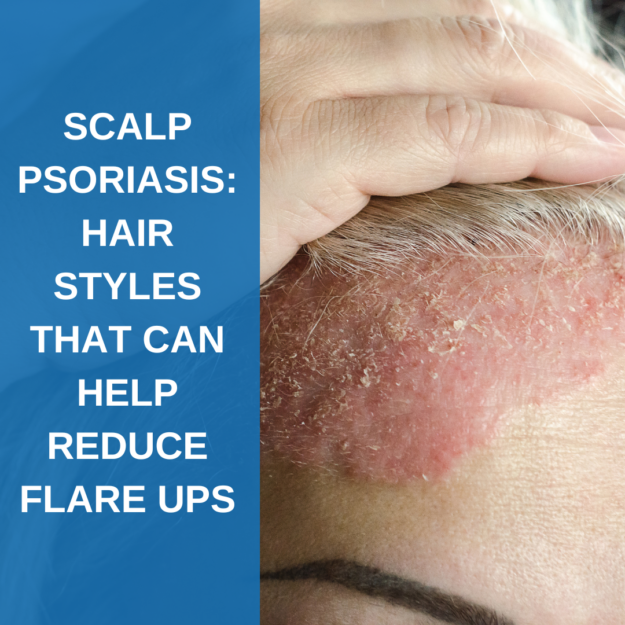 Scalp Psoriasis