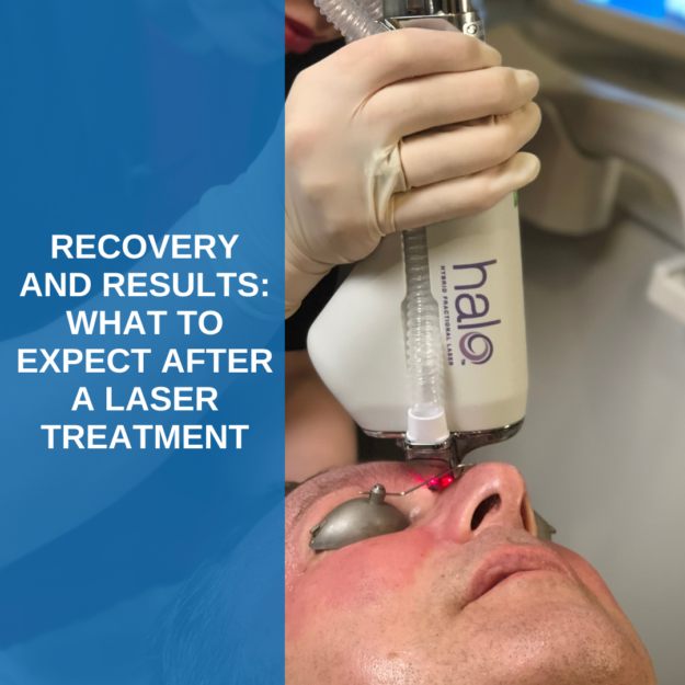 what to expect from halo laser