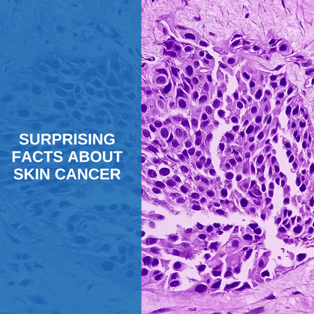 surprising skin cancer facts