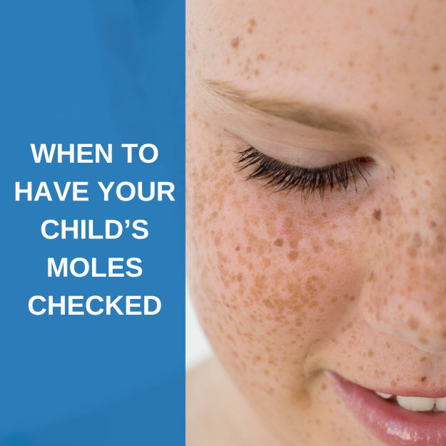 When to get your child’s moles checked