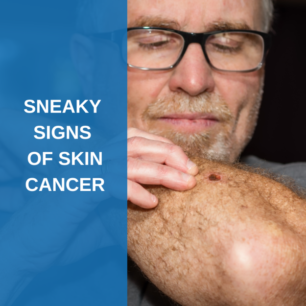 Sneaky Signs of Skin Cancer