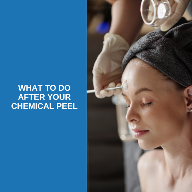 chemical peel aftercare